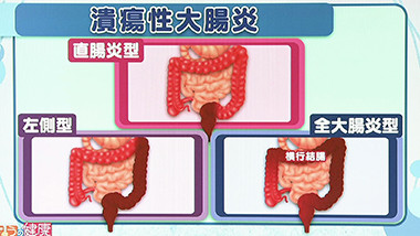 f:id:sna59717:20131116062825j:image f:id:sna59717:20131116062825j:image