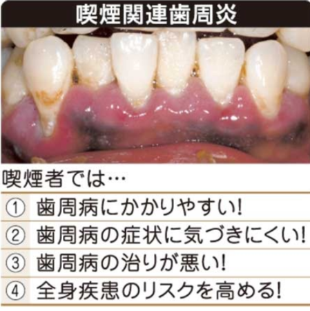 f:id:sna59717:20150321193211p:image