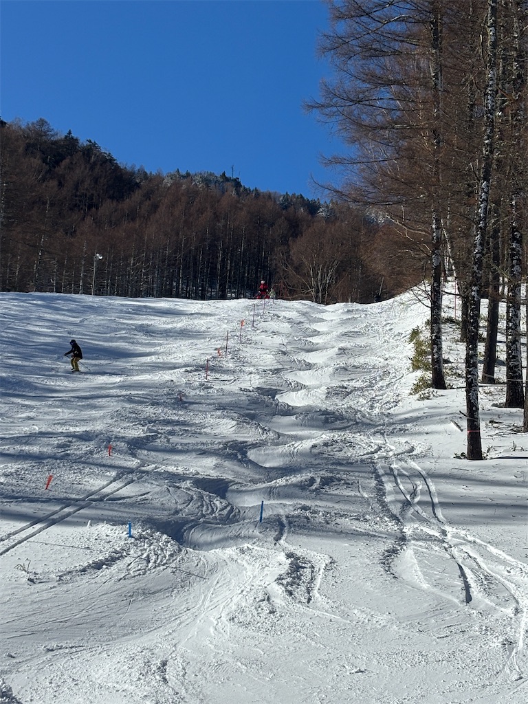 f:id:snowlimit_55:20260112161112j:image f:id:snowlimit_55:20260112161112j:image