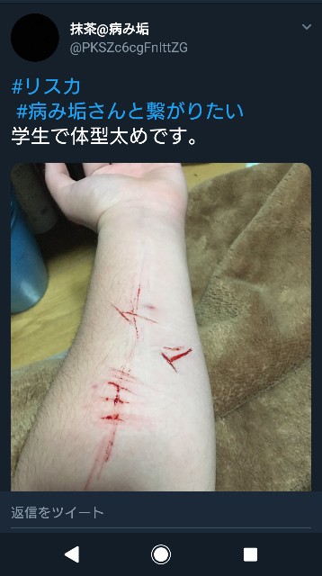 第一回 メンヘラ学 リスカマウンティング編 ゆこの話