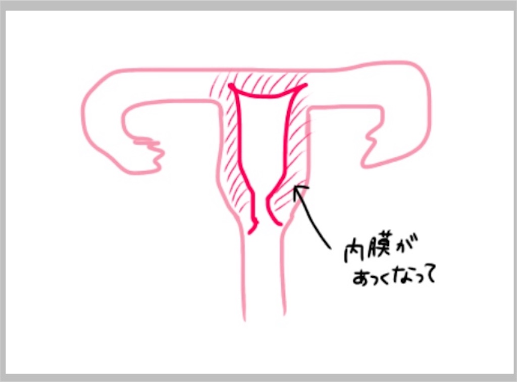 f:id:sobakasukarashimie:20190828234106j:image f:id:sobakasukarashimie:20190828234106j:image
