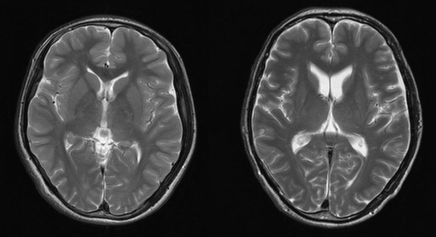 f:id:societyoffightingmedicine:20220121180751j:plain