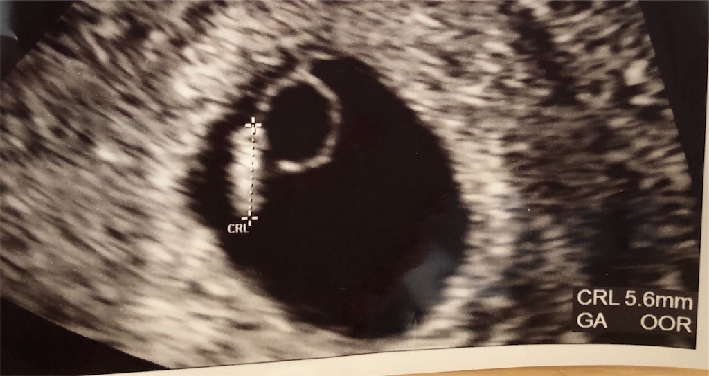 f:id:sonar_o:20190427172655j:image