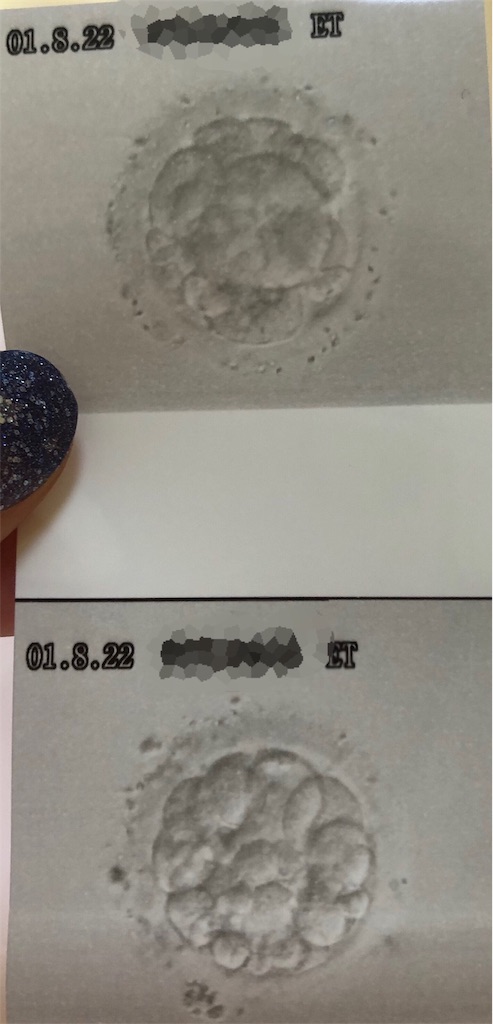 f:id:sonar_o:20190823004731j:image