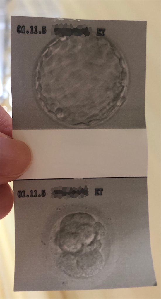 f:id:sonar_o:20191105175727p:image