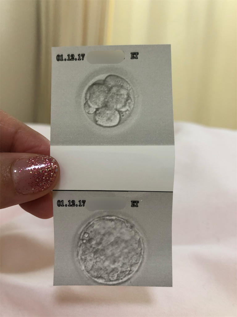 f:id:sonar_o:20191217154551p:image