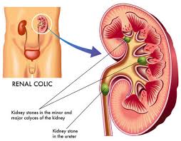 f:id:songjoong:20171120161408j:plain f:id:songjoong:20171120161408j:plain