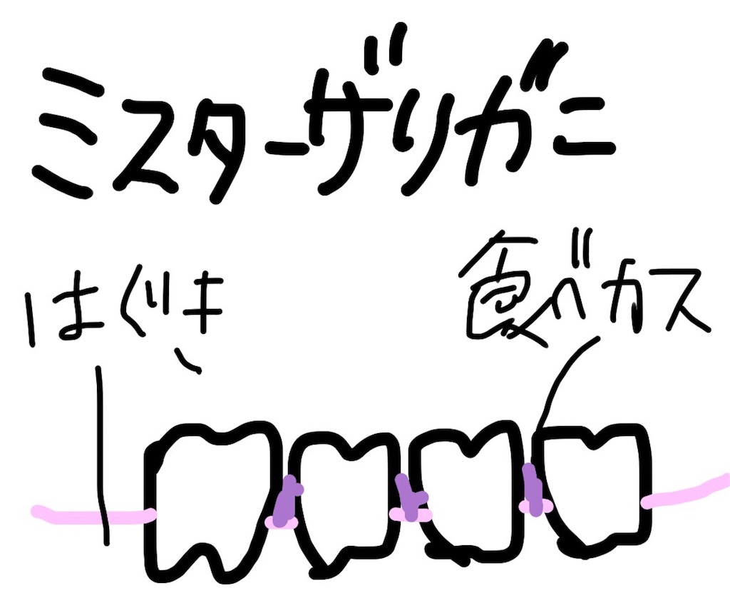 f:id:sonna-monkane:20180313210535j:image