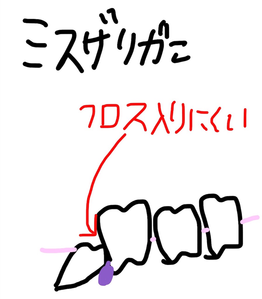 f:id:sonna-monkane:20180313211507j:image