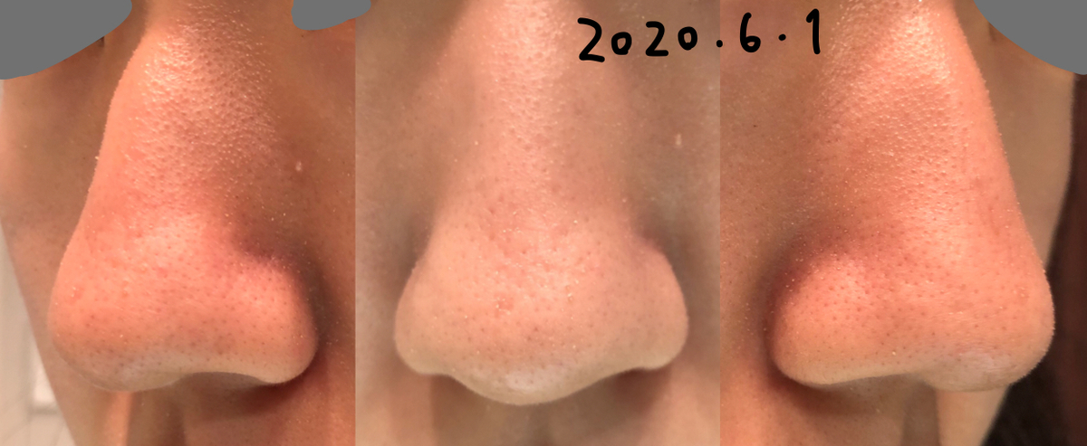 毛穴セラピストの肌断食記録