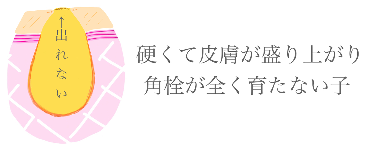 f:id:soraaroma:20200607145402j:plain