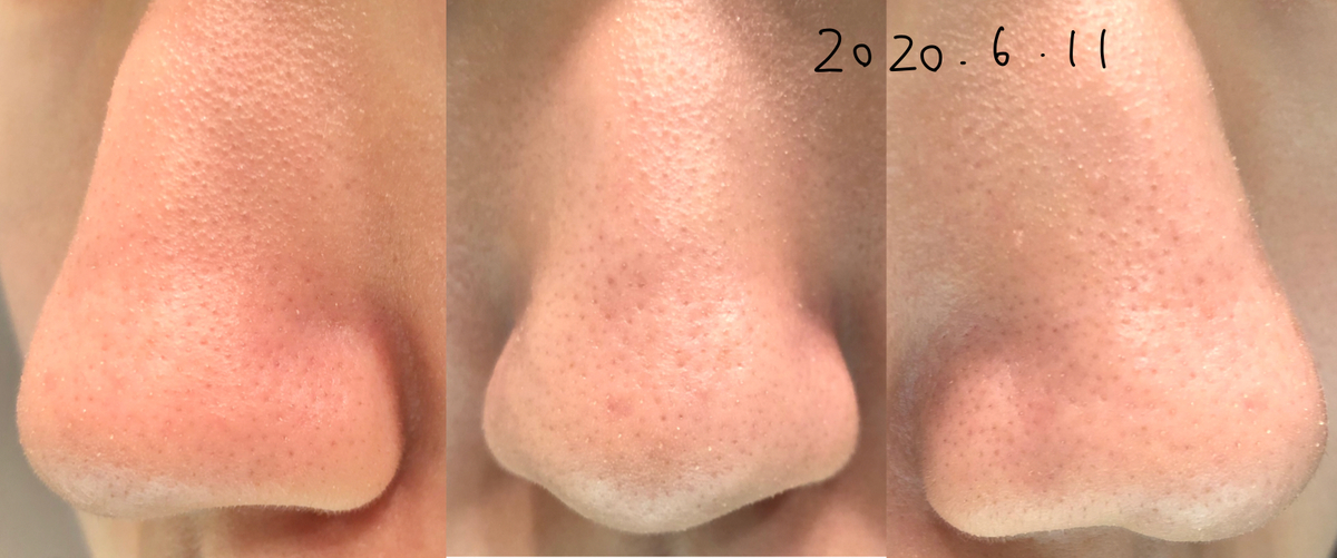 毛穴セラピストの肌断食記録