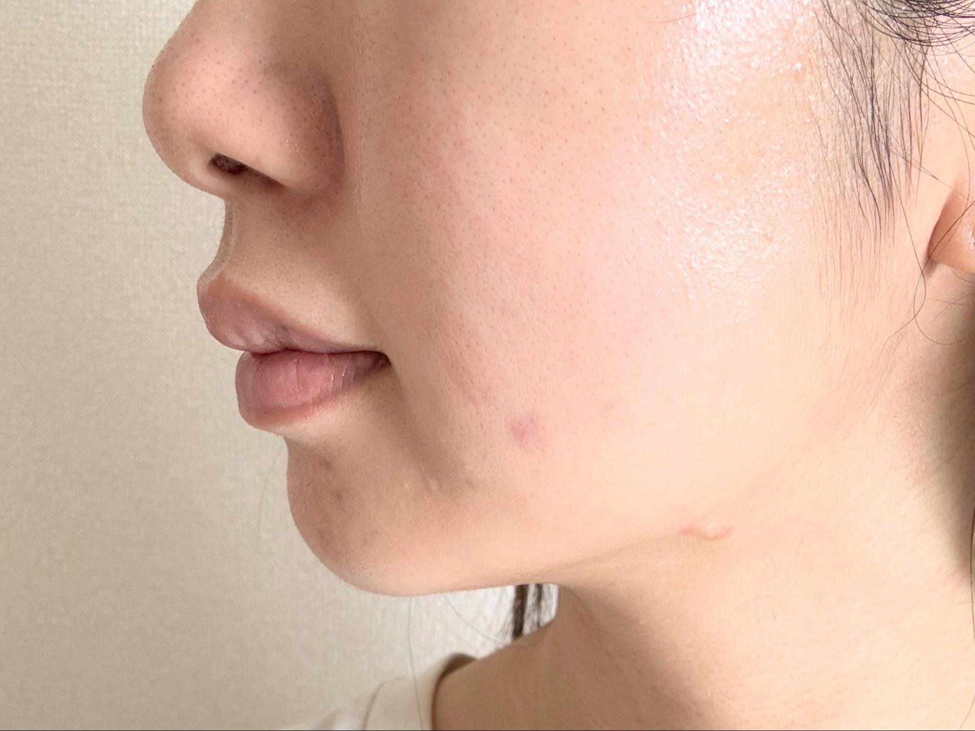 肌にうるおいが増している…！？