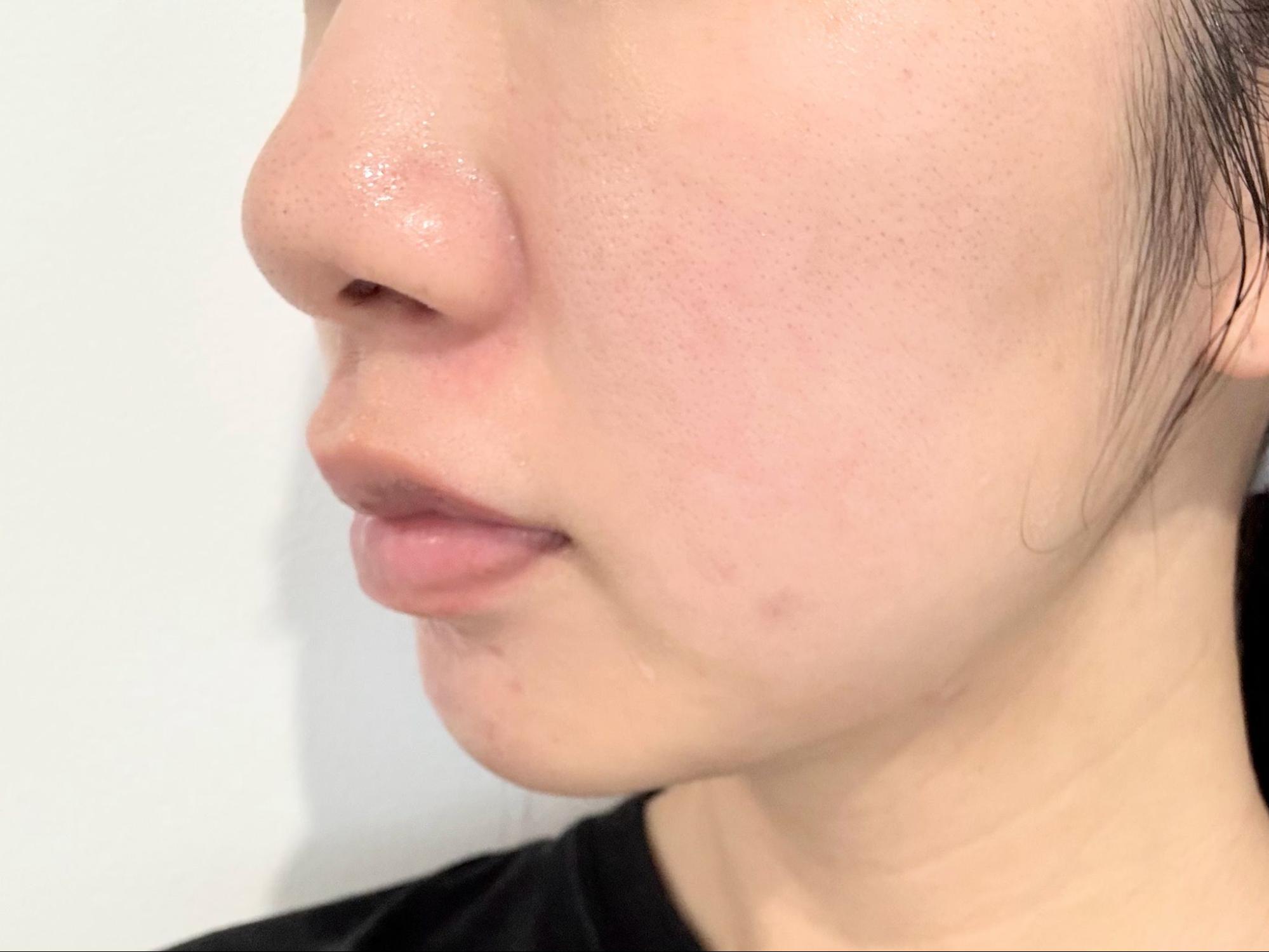 毛穴が目立ちにくいうるおい肌に