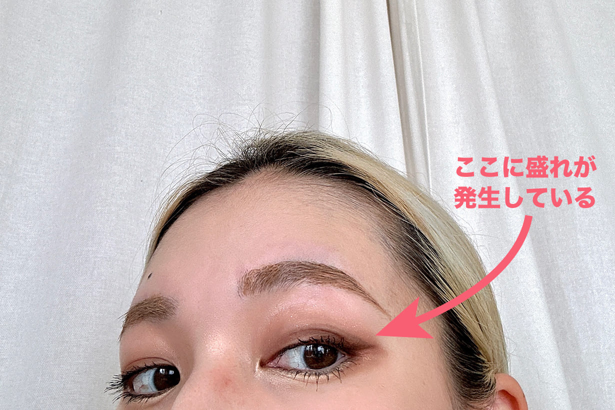 ダブルラインエキスパート