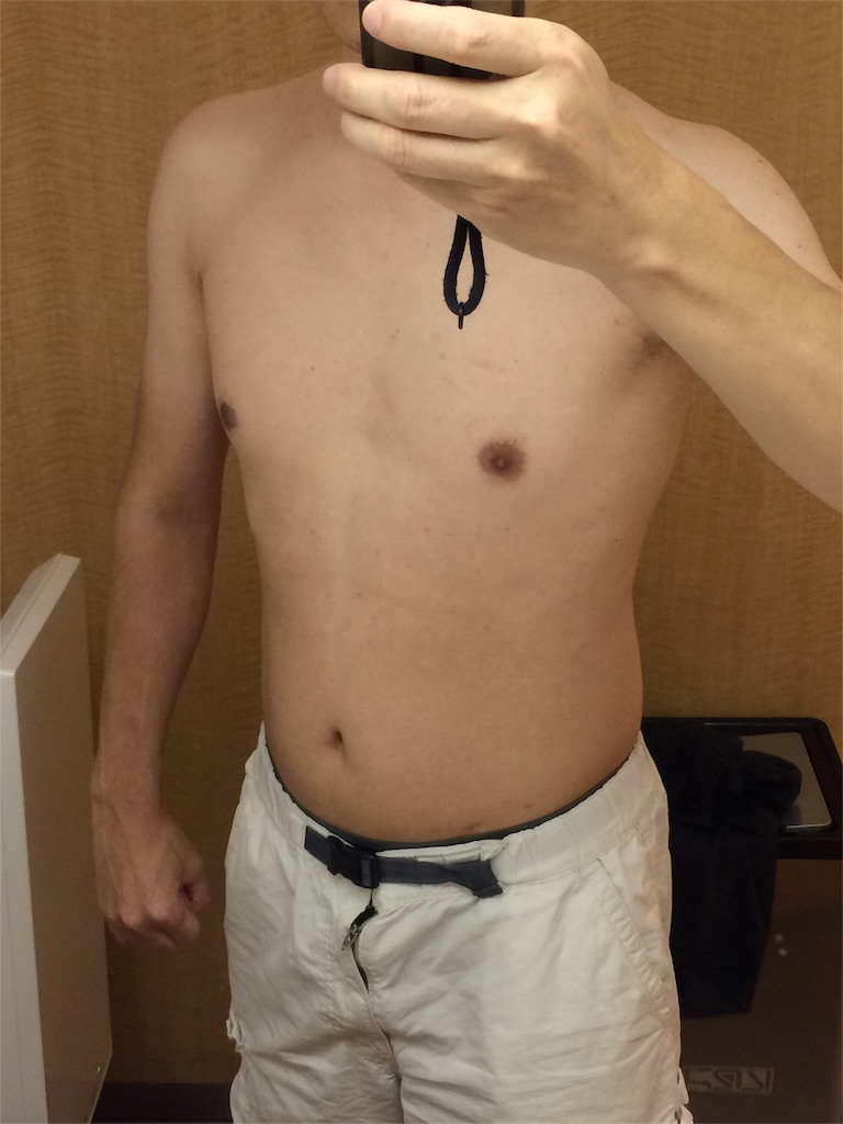 f:id:sos_jp:20161101005632j:image