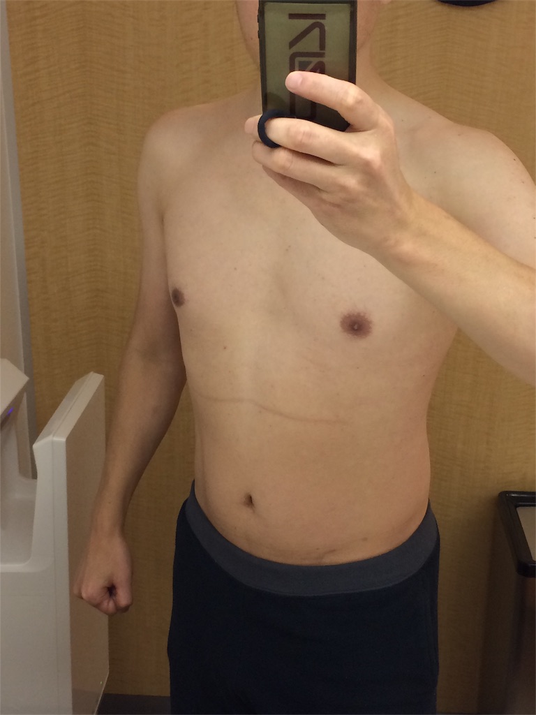 f:id:sos_jp:20161129020849j:image