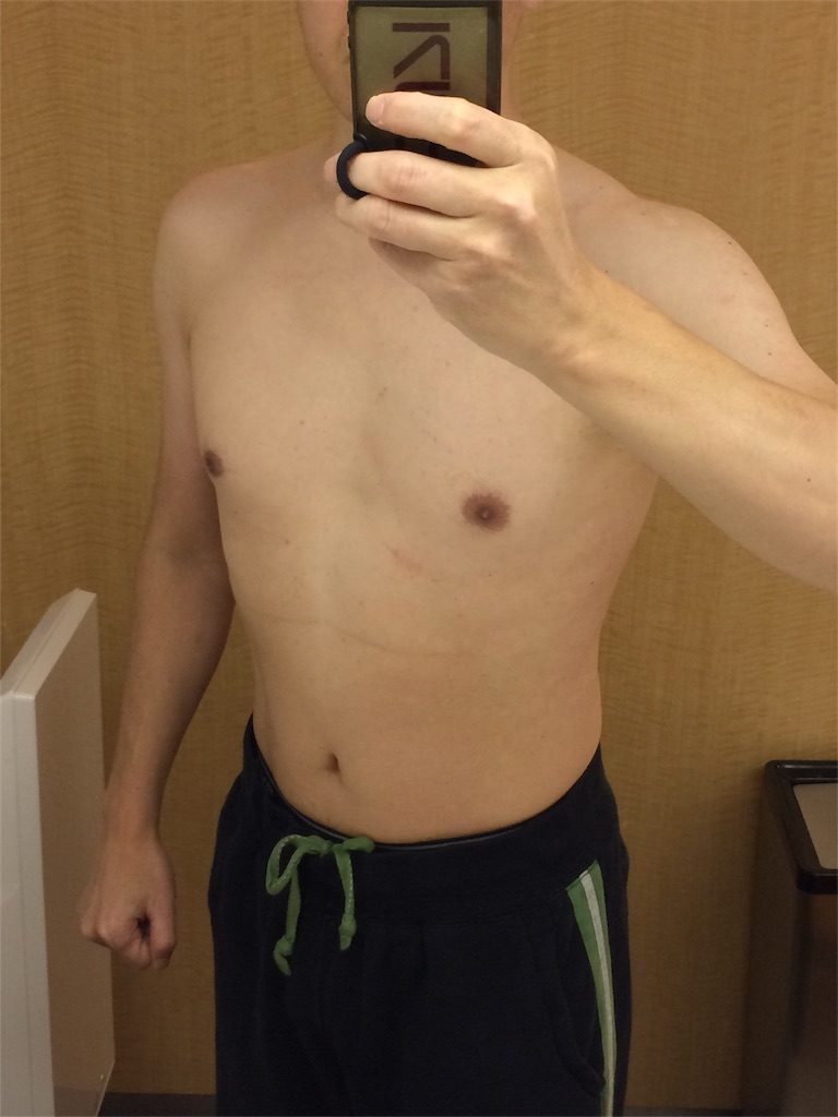 f:id:sos_jp:20161206015033j:image