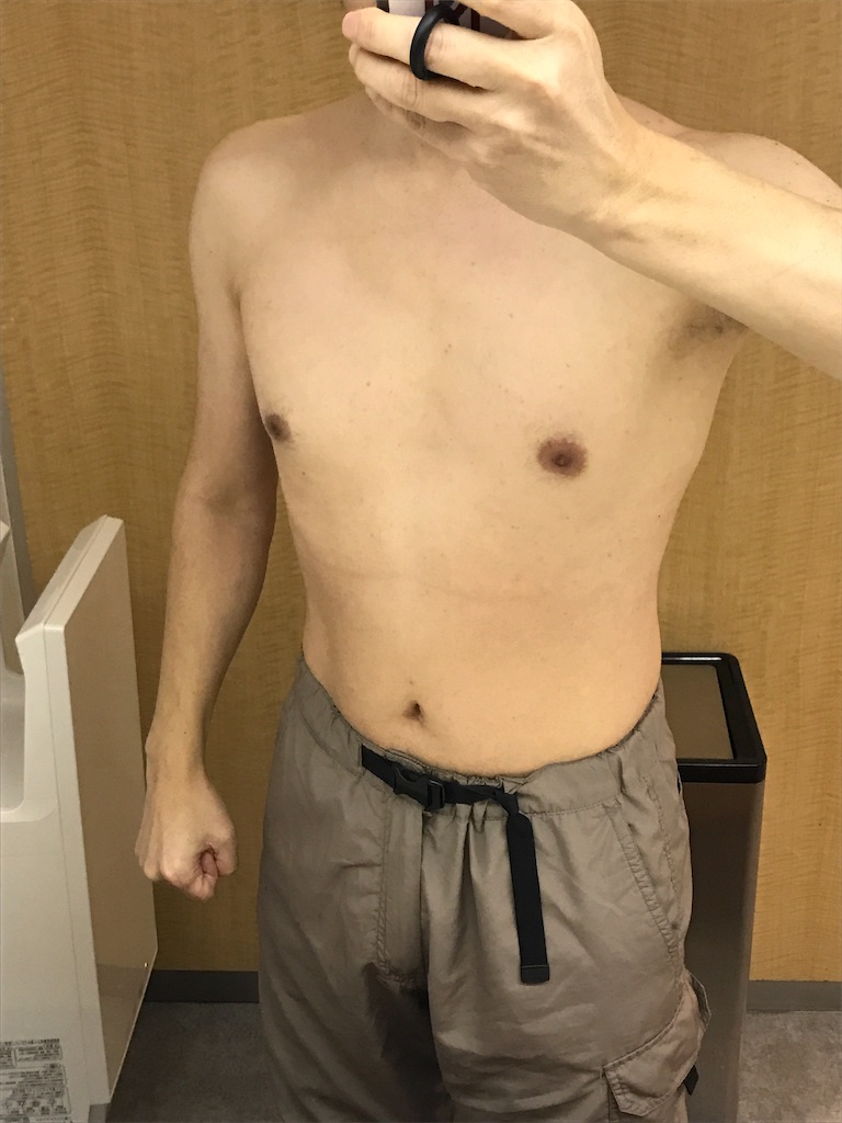 f:id:sos_jp:20170220025825j:image