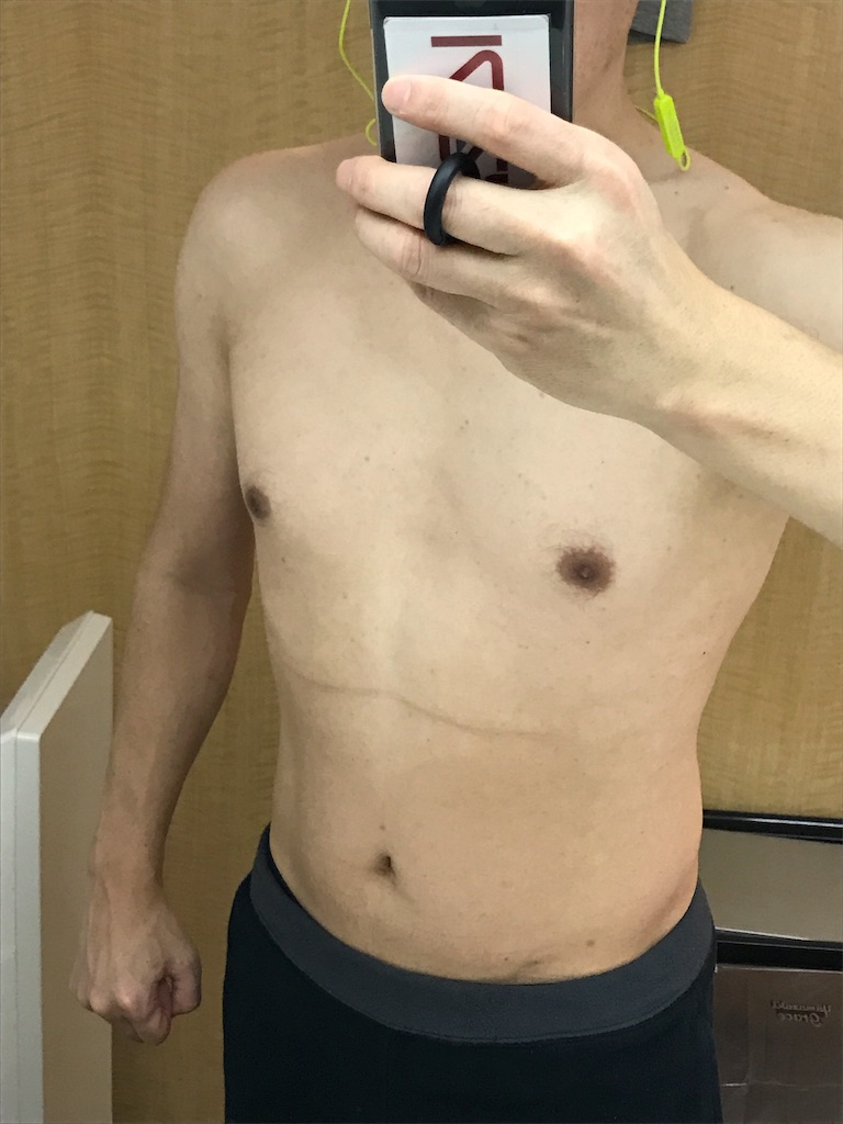 f:id:sos_jp:20170303192736j:image