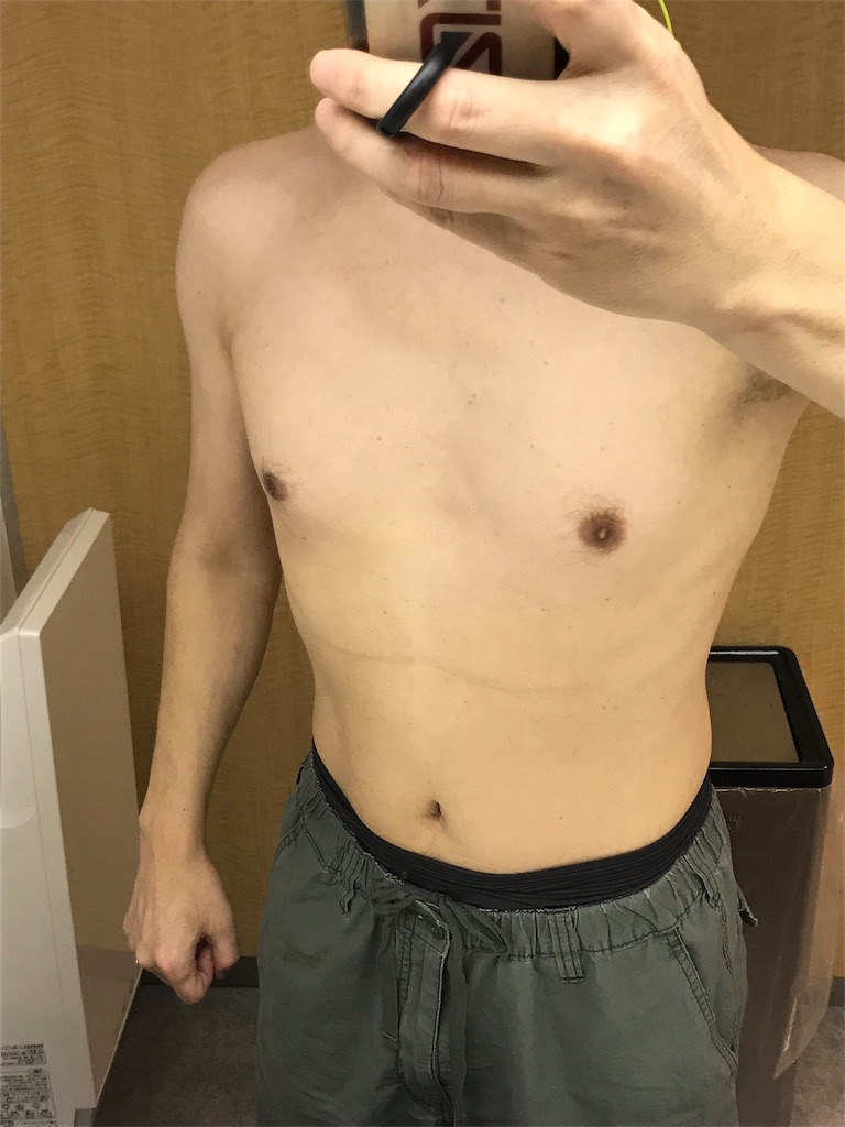 f:id:sos_jp:20170725023510j:image