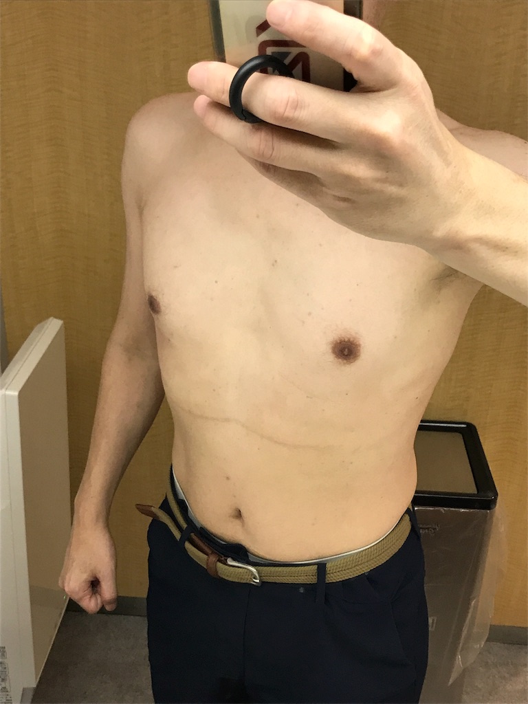 f:id:sos_jp:20170801005714j:image