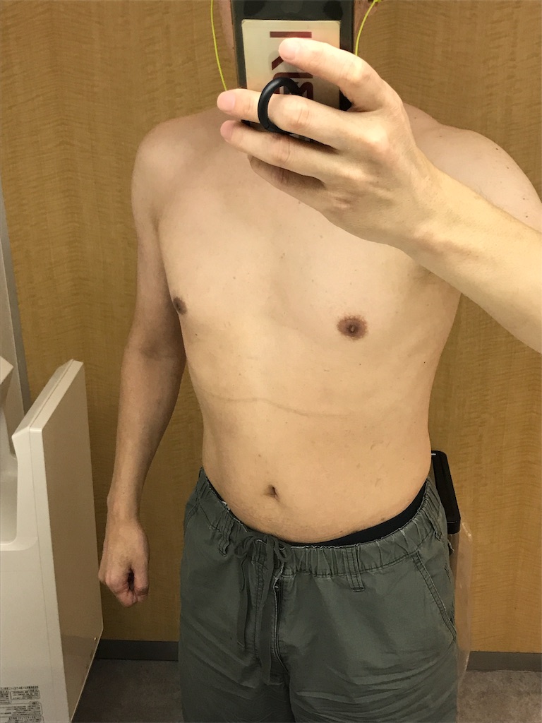 f:id:sos_jp:20170905022848j:image f:id:sos_jp:20170905022848j:image