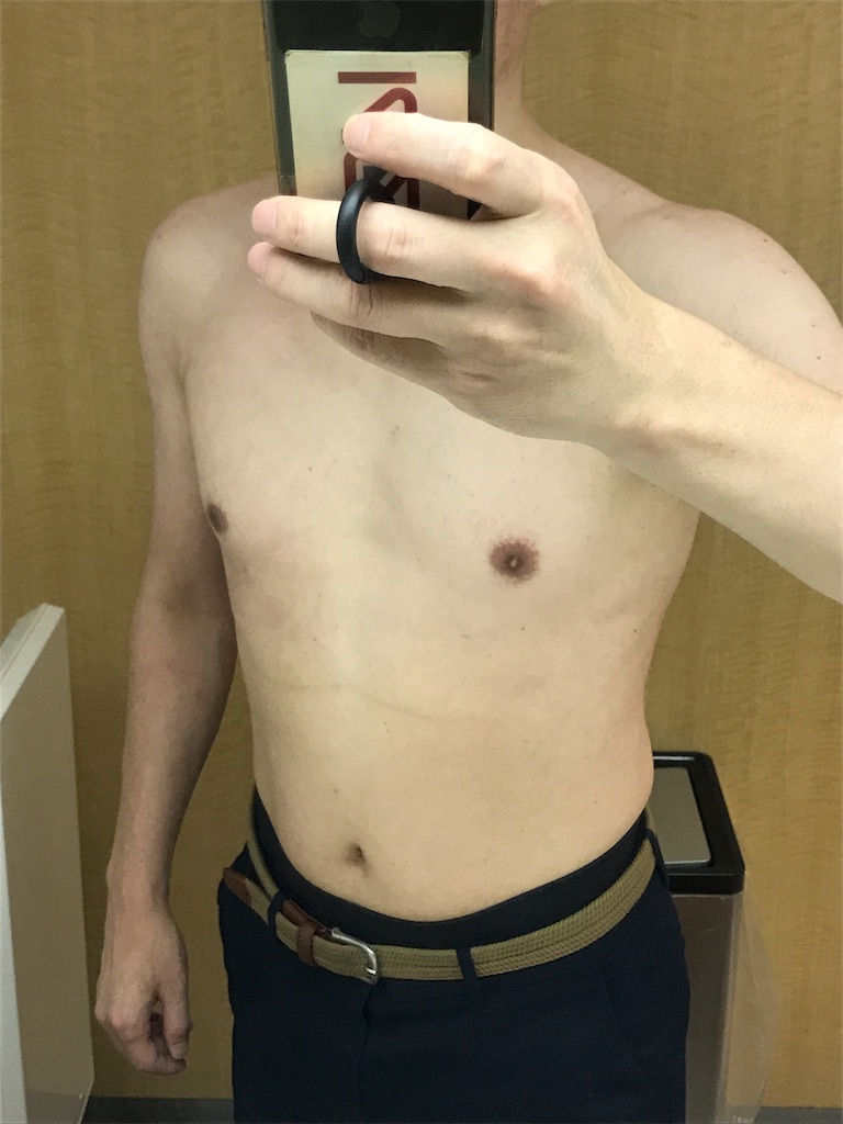 f:id:sos_jp:20170914010705j:image f:id:sos_jp:20170914010705j:image