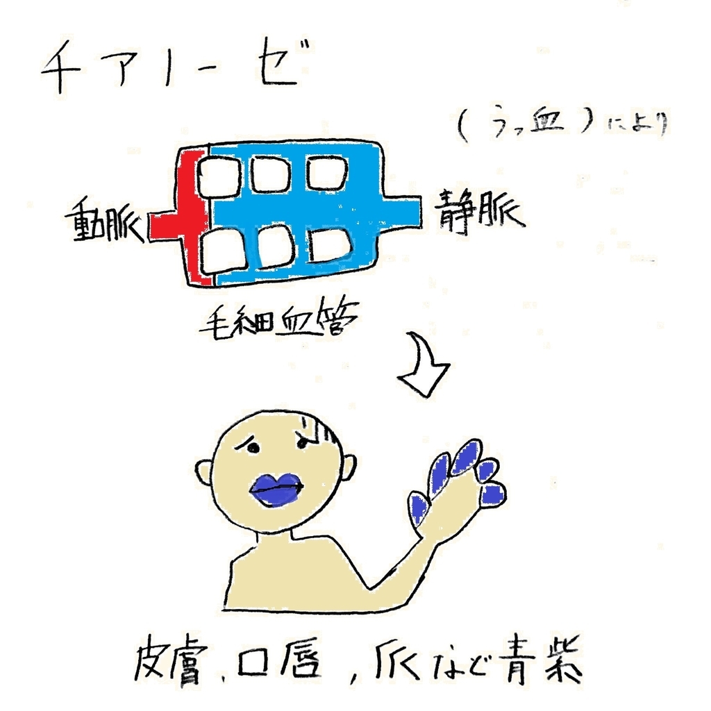 f:id:spcom:20181110172456j:plain f:id:spcom:20181110172456j:plain