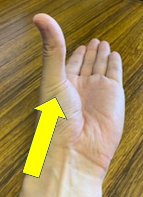 f:id:spine_neuro:20210604204831j:plain