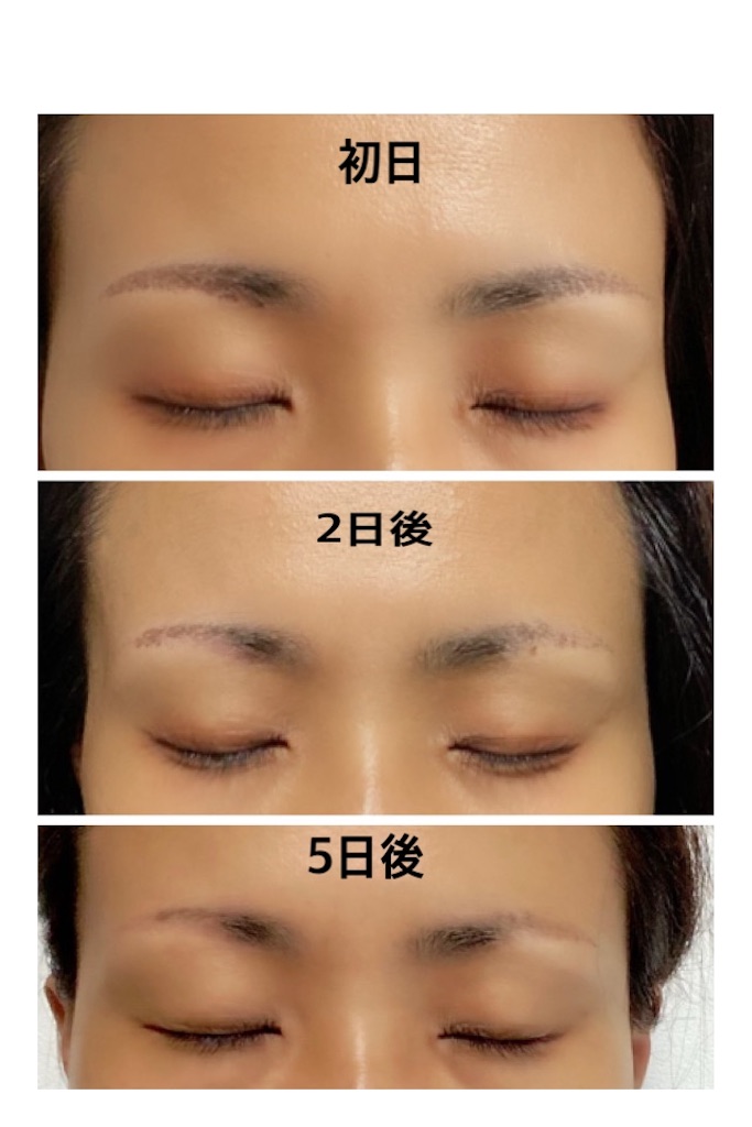 f:id:ssachiko:20200611165627j:image f:id:ssachiko:20200611165627j:image