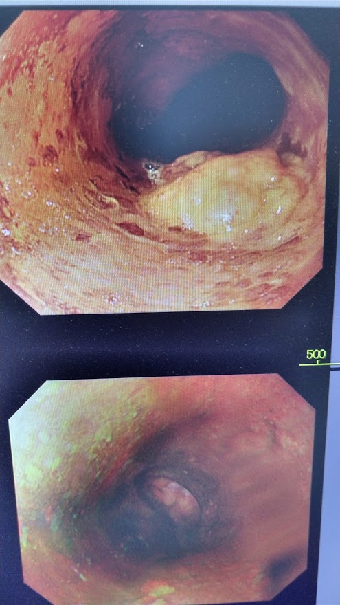 f:id:ssshoutenn:20210324065223j:plain