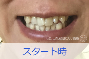 沖縄の薬用ちゅらトゥースホワイトニング 口コミ 歯が白くなる効果あるの わたしのお気に入り通販日記