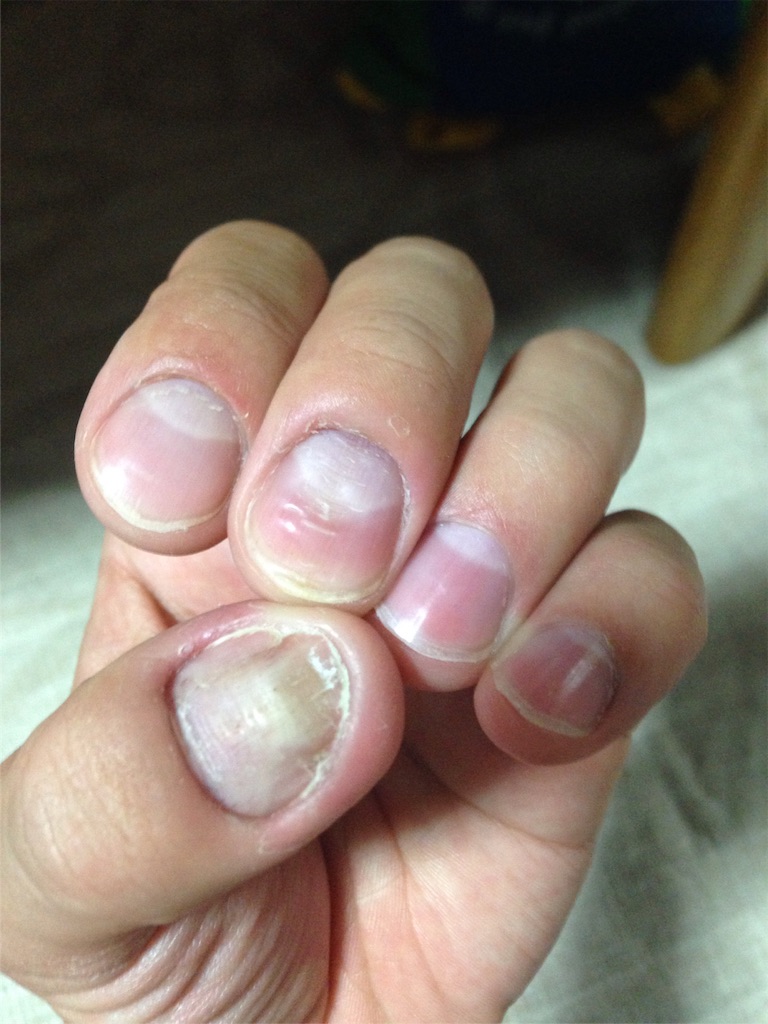 f:id:stoicman:20151018202458j:image f:id:stoicman:20151018202458j:image