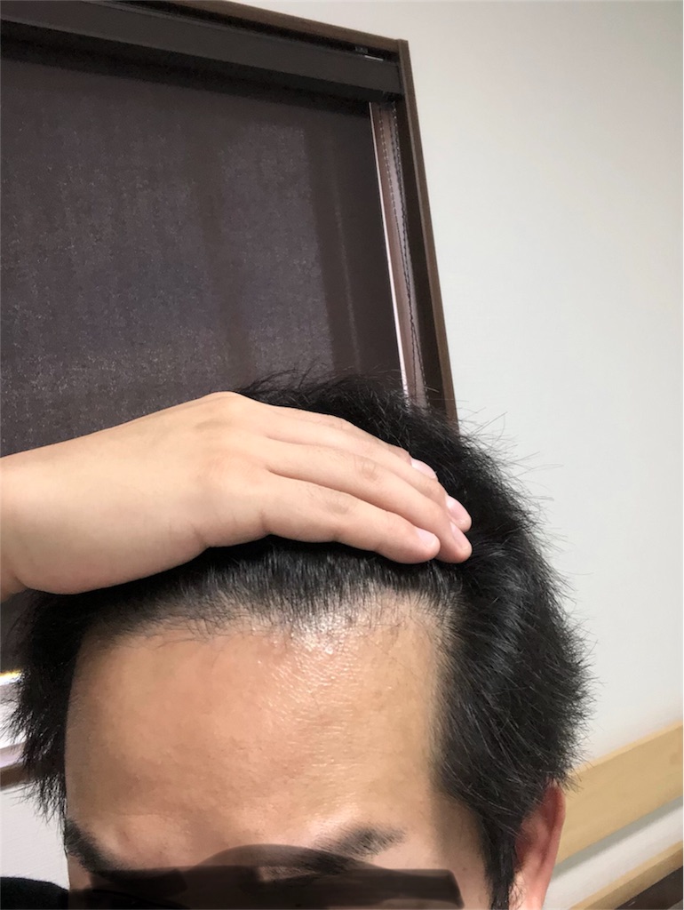 f:id:stoicman:20181007114851j:plain f:id:stoicman:20181007114851j:plain