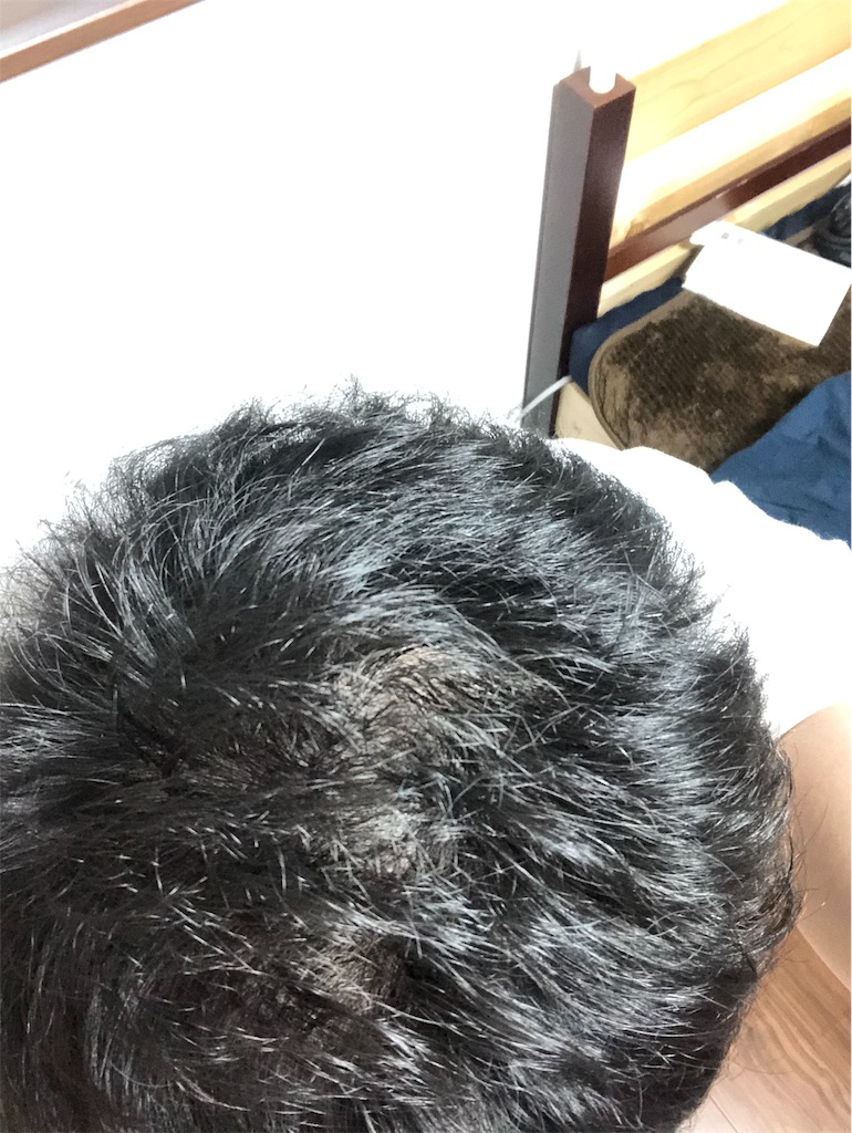 f:id:stoicman:20190323181714j:plain f:id:stoicman:20190323181714j:plain
