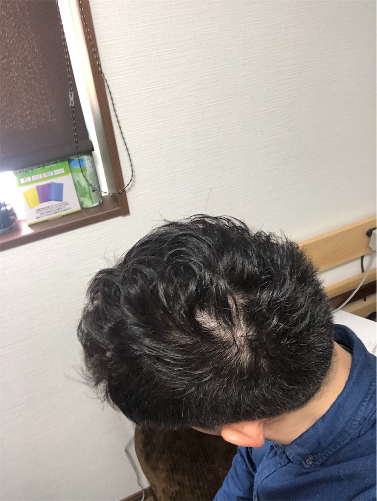 f:id:stoicman:20190331121429j:plain f:id:stoicman:20190331121429j:plain