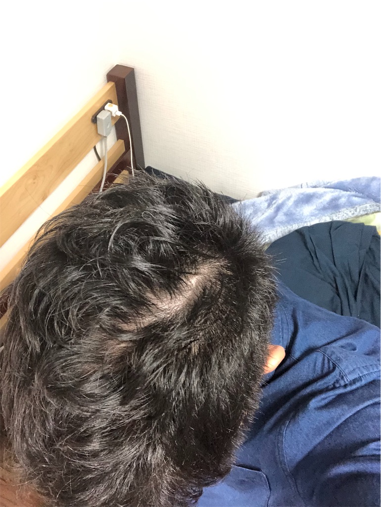 f:id:stoicman:20190331121438j:plain f:id:stoicman:20190331121438j:plain
