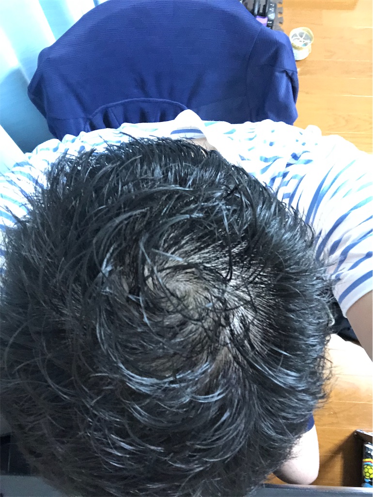 f:id:stoicman:20190711183633j:plain f:id:stoicman:20190711183633j:plain