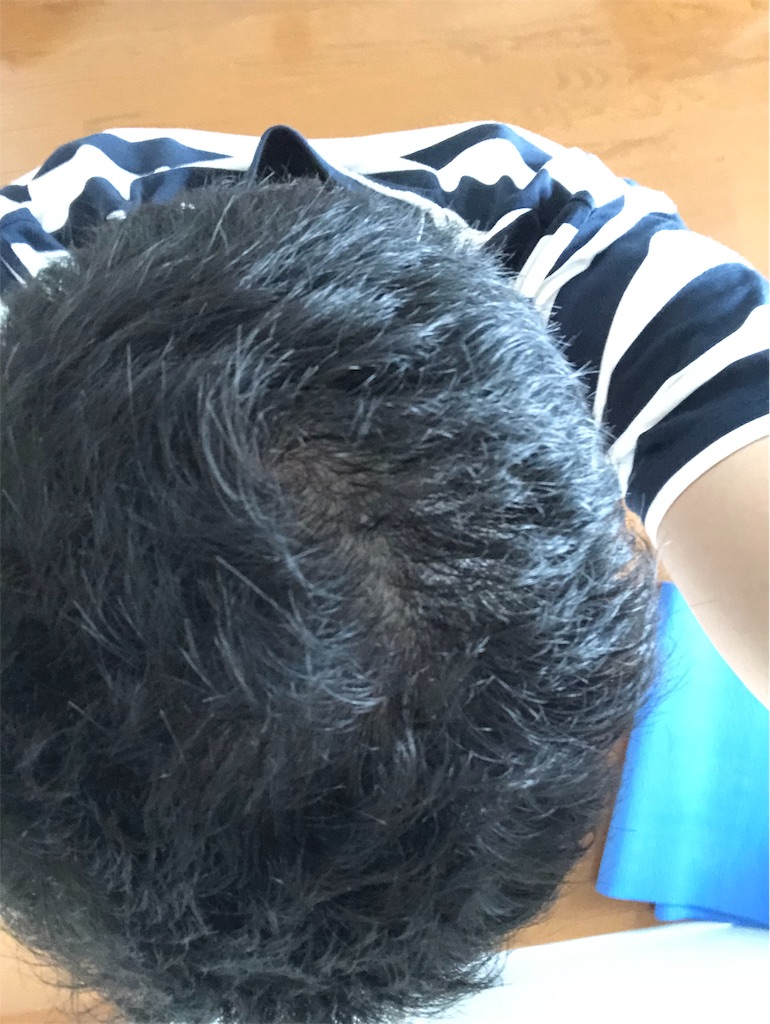 f:id:stoicman:20190825152754j:plain f:id:stoicman:20190825152754j:plain