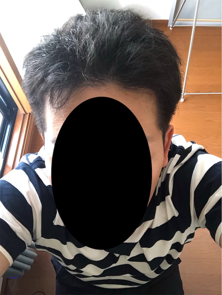 f:id:stoicman:20190825152757j:plain f:id:stoicman:20190825152757j:plain