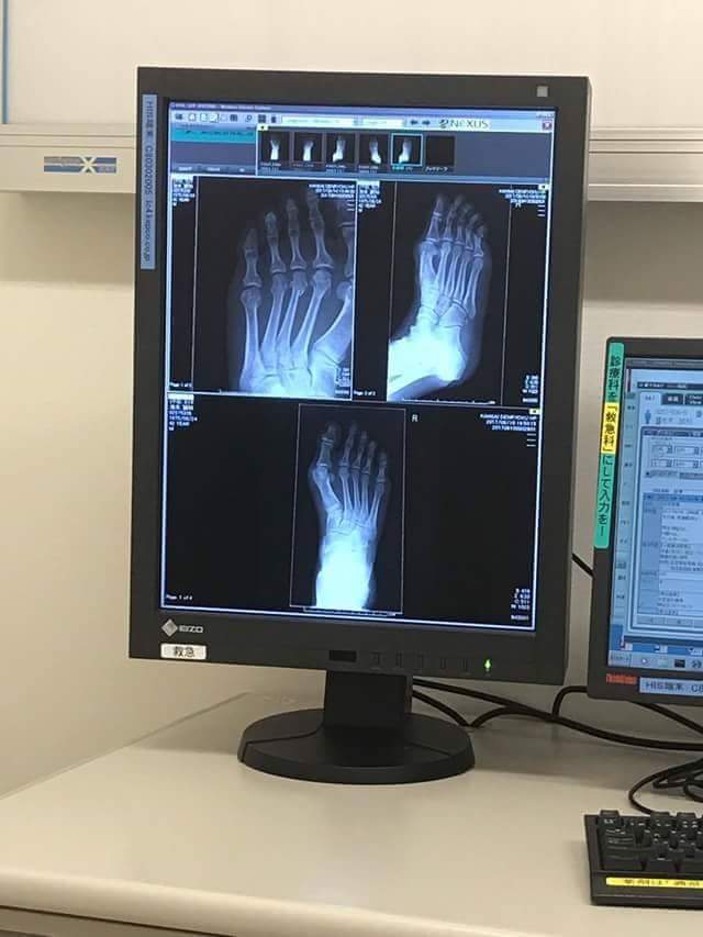 f:id:strongstylehistory:20170913070548j:plain f:id:strongstylehistory:20170913070548j:plain