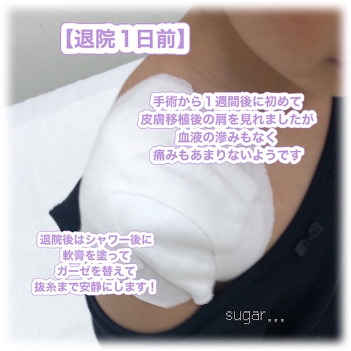 f:id:sugar0222:20250818144544j:image f:id:sugar0222:20250818144544j:image