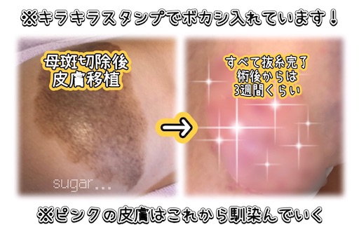 f:id:sugar0222:20250829182114j:image