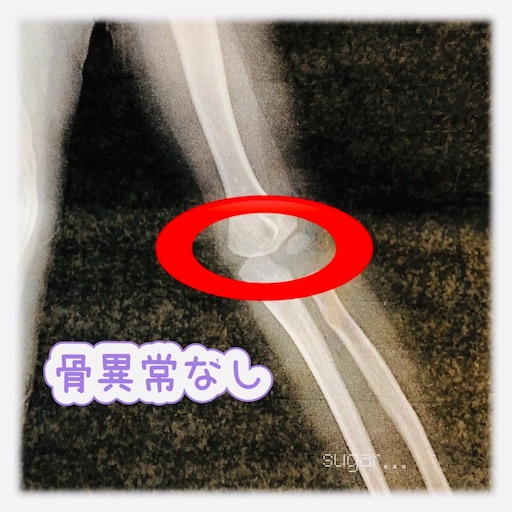 f:id:sugar0222:20251204145133j:image