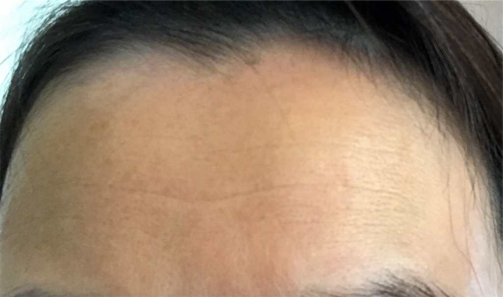 シワが消えるミスト すぎまりの日記