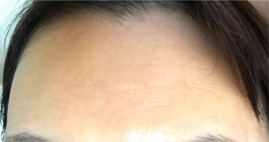 シワが消えるミスト すぎまりの日記