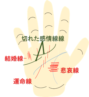 鑑定例悲哀線40代女性左手