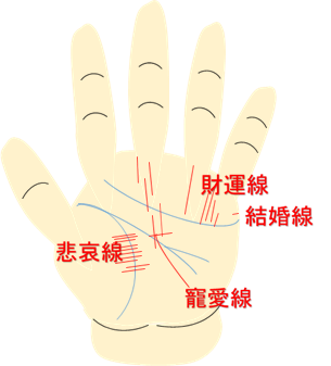 鑑定例４０代女性左手悲哀線