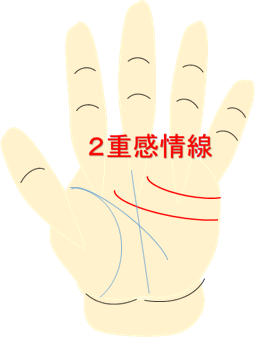 2重感情線